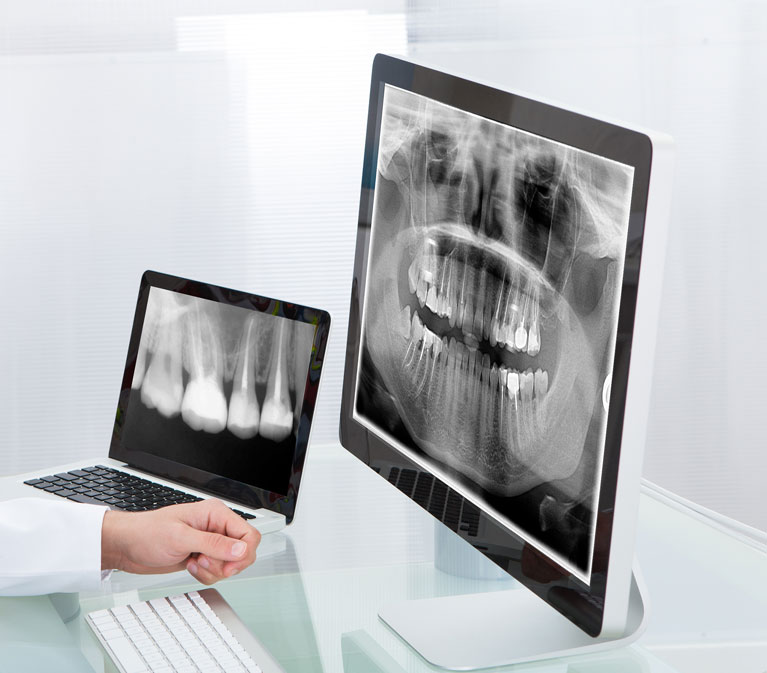 X-rays on computer monitors |